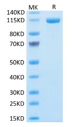 SDS-PAGE FAP-372H.jpg